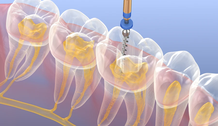 Endo-Pagodes